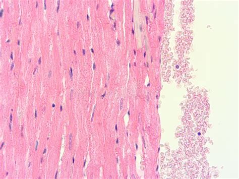 Histología Del Tejido Del Ser Humano Del Corazón Imagen De Archivo Imagen De Humano Conectivo