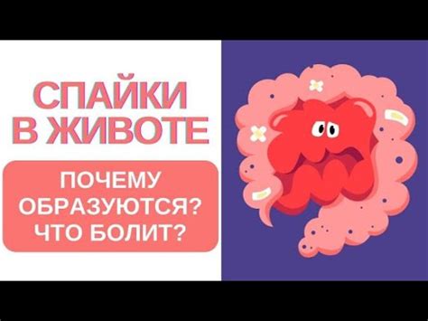 🔥 Спайки в животе. Почему образуются? Средство! - YouTube