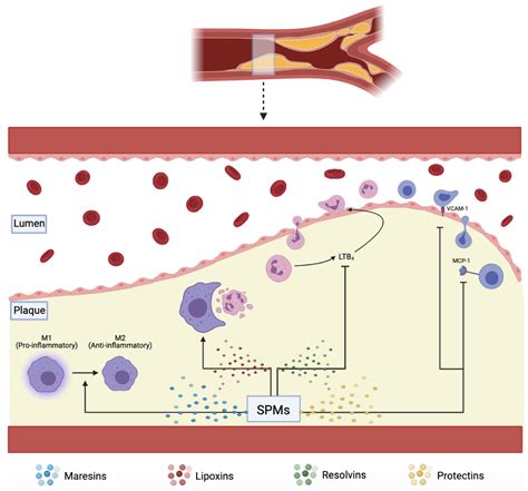 Biomedicines Free Full Text Critical Role Of Inflammation And Specialized Pro Resolving