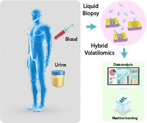 Liquid Biopsy Based Volatile Organic Compounds From Blood And Urine And