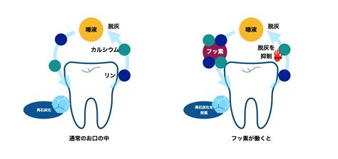 歯を守る！フッ素入りアイテムで虫歯予防 新浦安の歯医者・歯科｜栗林歯科医院｜各専門医在籍