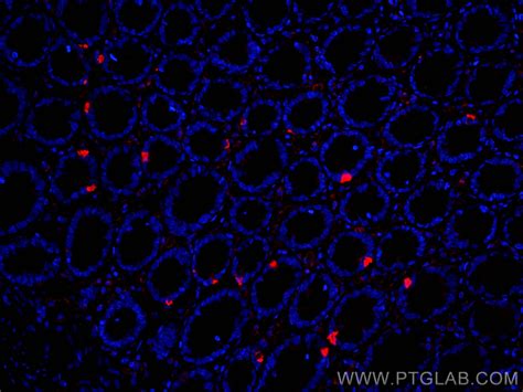 XIAP Antibody 66800 1 PBS Proteintech