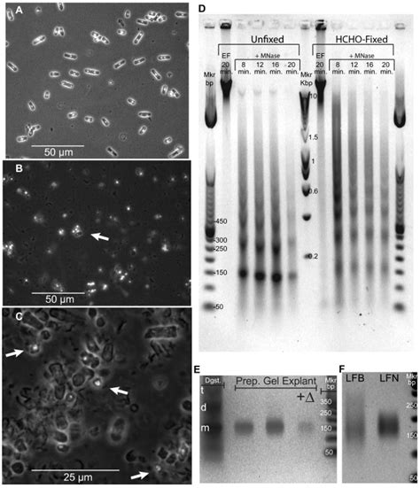 Micrococcal Nuclease Mnase Digestion Of Chromatin Within Fission