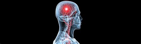 control  stroke risk blog