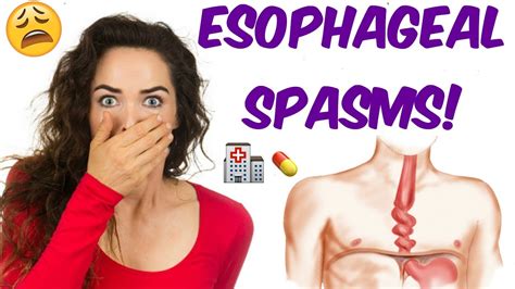 Diffuse Esophageal Spasm