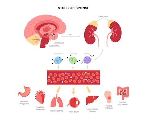 Stressreaktionssystem Hypothalamus Hypophysen Nebennieren Achse