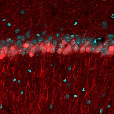 Scientists Watch Activity of Newborn Brain Cells in Mice; Reveal they ...