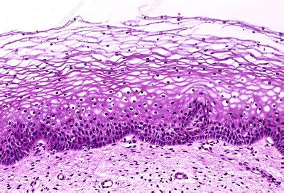 Cervix epithelium, light micrograph - Stock Image - C001/8836 - Science Photo Library