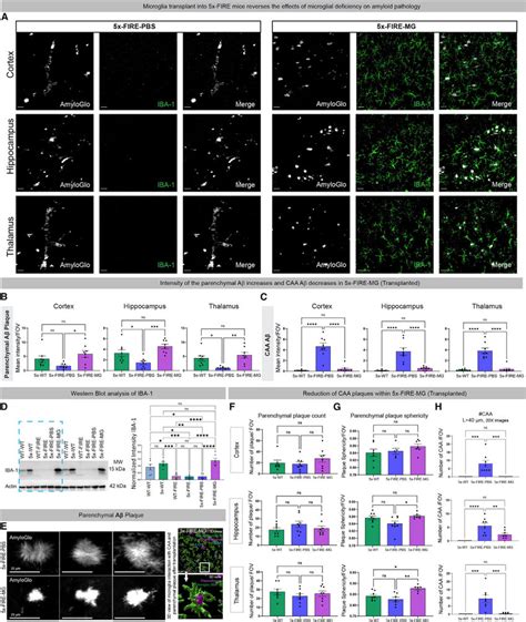 Adult Transplantation Of Wild Type Donor Microglia Prevents The Effects