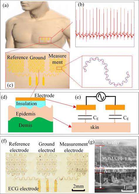 Schematic Illustration Of The Bio Potential Electrode For Ecg