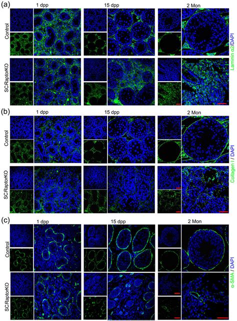 Immunofluorescent images of laminin α2 chain a basement membrane