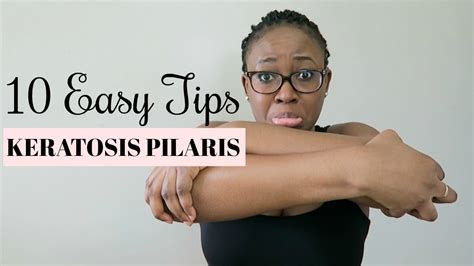 How To Treat And Reduce Chicken Skin Keratosis Pilaris In 10 Easy Ways