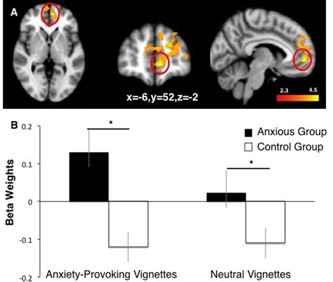 Neural Activation In Anxious And Healthy Youth A Greater Medial