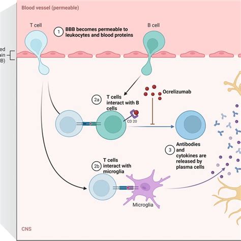 The Implication Of Ocrelizumab As An Anti‐cd20 Antibody In Multiple