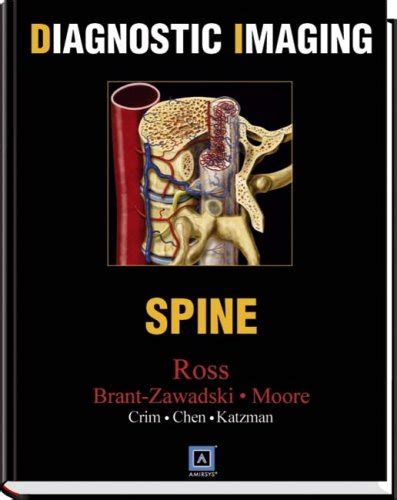 『diagnostic Imaging Spine』｜感想・レビュー 読書メーター