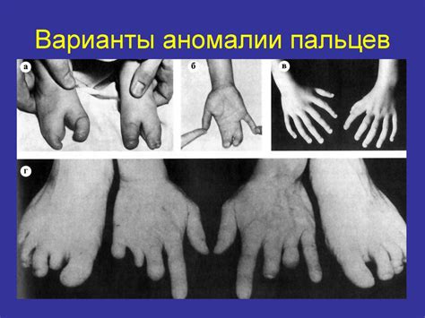 Эволюция систем органов. Онтофилогенетическая обусловленность пороков ...