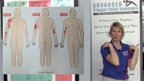 Elbow Pain Tennis Elbow Golfer S Elbow Could Be Trigger Points In The Triceps Muscle Youtube