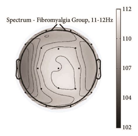 Topographic Maps Of The Power Spectrum In The Alpha 2 11 12 Hz