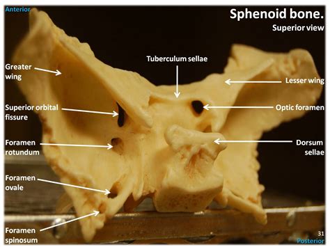 Sphenoid Bone Superior View With Labels Axial Skeleton Flickr Photo Sharing