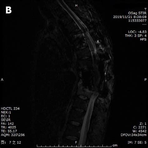 Computed Tomography And Magnetic Resonance Imaging A Postoperative