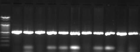 2 Gel Electrophoresis Of Amplified The 16s Rrna Gene Using E Coli