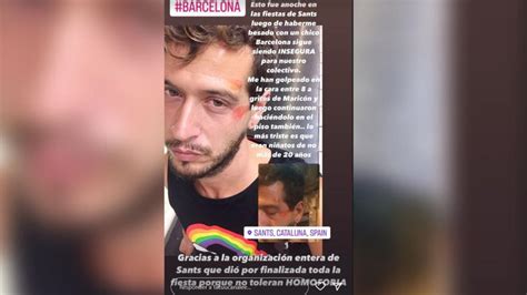 Una Mujer Denuncia Una Agresión Sexual En Un Ascensor Del Metro De