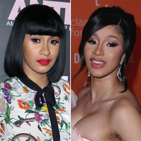 Has Cardi B Had Plastic Surgery Transformation Photos Quotes Life