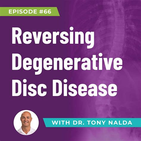 Episode 66 Reversing Degenerative Disc Disease