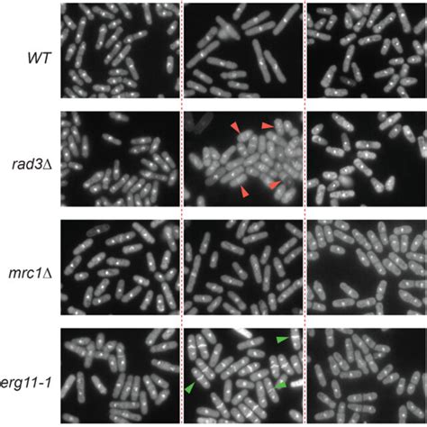 Microscopic Examination Of The Hu And Gz Treated S Pombe Wild Type