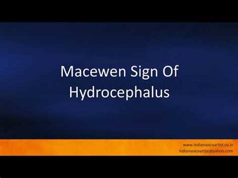 Pronunciation of the word(s) "Macewen Sign Of Hydrocephalus". - YouTube