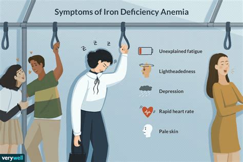 Iron Deficiency Anemia: Symptoms, Causes, Diagnosis, and Treatment