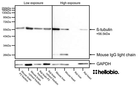 Anti Beta Tubulin Antibody Validab Beta Tubulin Loading Control