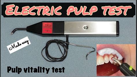 Electric Pulp Test Ii Pulp Vitality Test Ii Endodontics Ii Made Easy