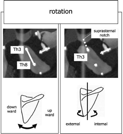 Upwarddownward Rotation And Internalexternal Rotation Of The Scapula Download Scientific