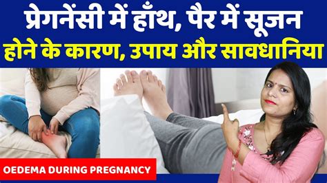 Pregnancy Me Hath Pair Me Sujan Aur Dard Ke Karan Aur Upay Oedema