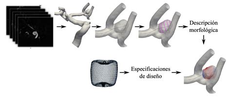 Modelos De Simulaci N De Dispositivos Intrasaculares Para El