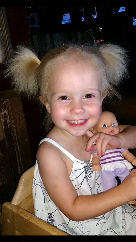 Mom Freaks When 2-Yr-Old's Hair Turns White, But Doctors Reveal She ...