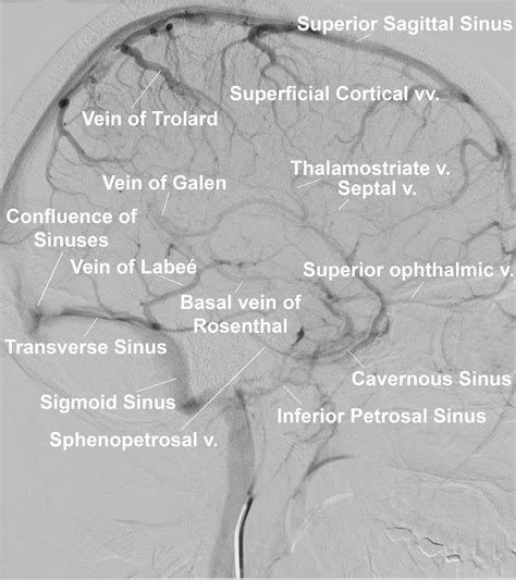 Venous Anatomy | The Neurosurgical Atlas