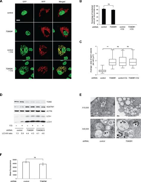 Figures And Data In Transglutaminase 2 Contributes To A TP53 Induced