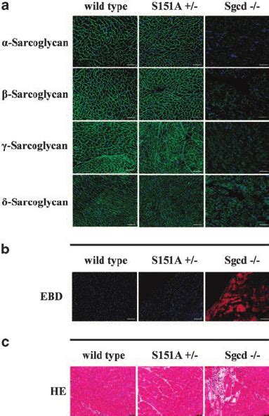 The Sarcolemmal Membrane Of Year Old Heterozygous S A Knock In Mice