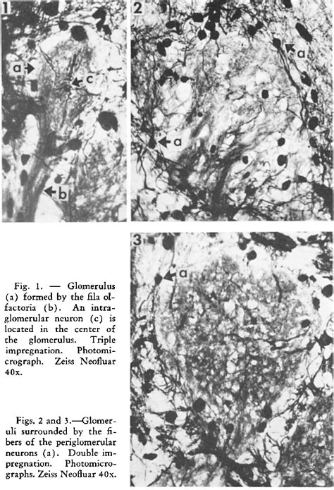 Figure 1 from LVI The Histology of the Human Olfactory Bulb and the Extracerebral Part of the ...