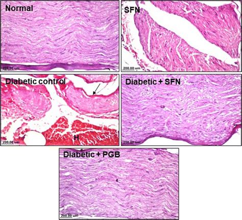 Effect Of Sulforaphane On Diabetes Induced Histopathological Changes In