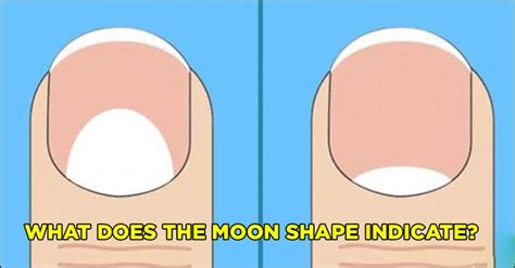 Do You Have White Spots Half Moon On Your Nails Heres What They