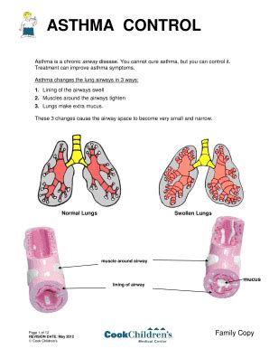 Fillable Online Asthma Control Fax Email Print Pdffiller