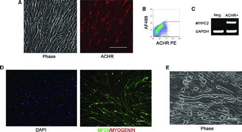 Isolation Of Achr Skeletal Myocytes A Phase Contrast Image Left