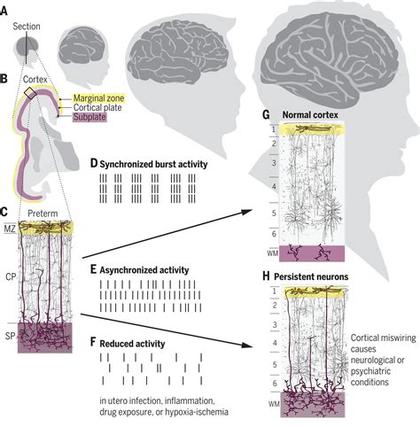 Transient Cortical Circuits Match Spontaneous And Sensory Driven