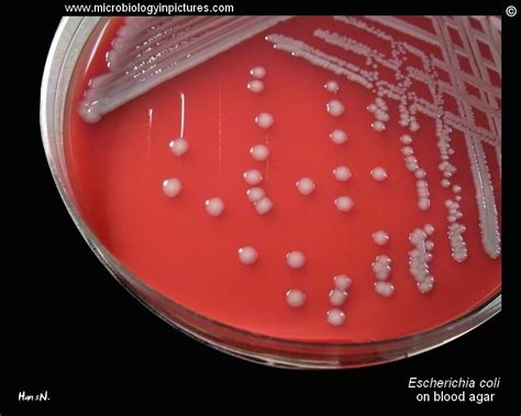 Can Escherichia Coli Grow On Blood Agar