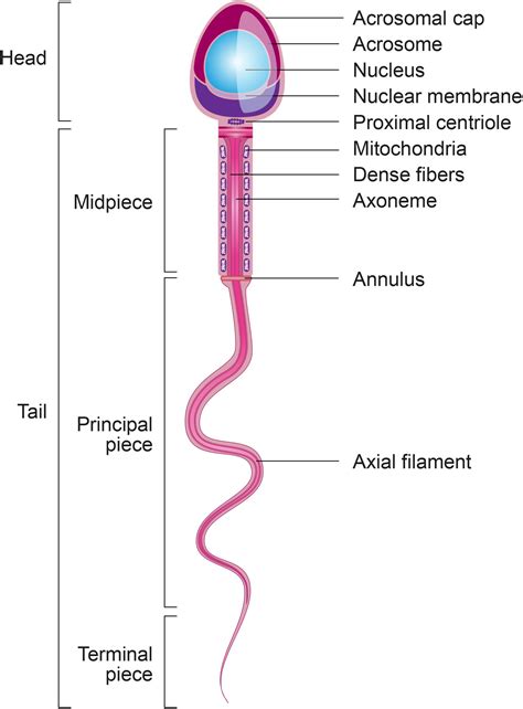 Spermatocele Diagram