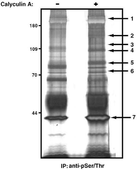 Figure From A Mass Spectrometry Based Proteomic Approach For