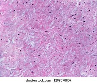 Umbilical Cord Contains Mucous Connective Tissue Stock Photo 1299578809 ...